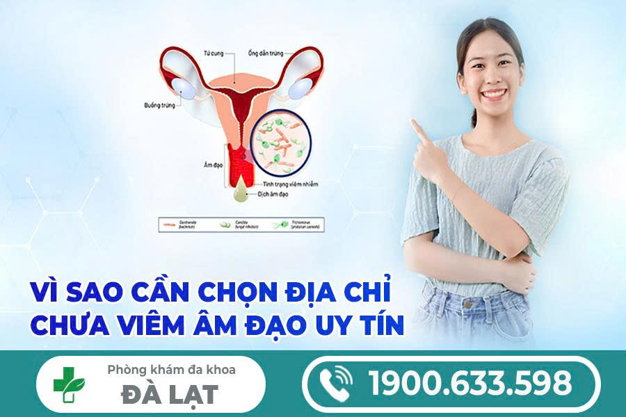 Hình ảnh minh họa